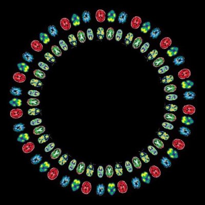 Your brain on drugs. Literally round preview